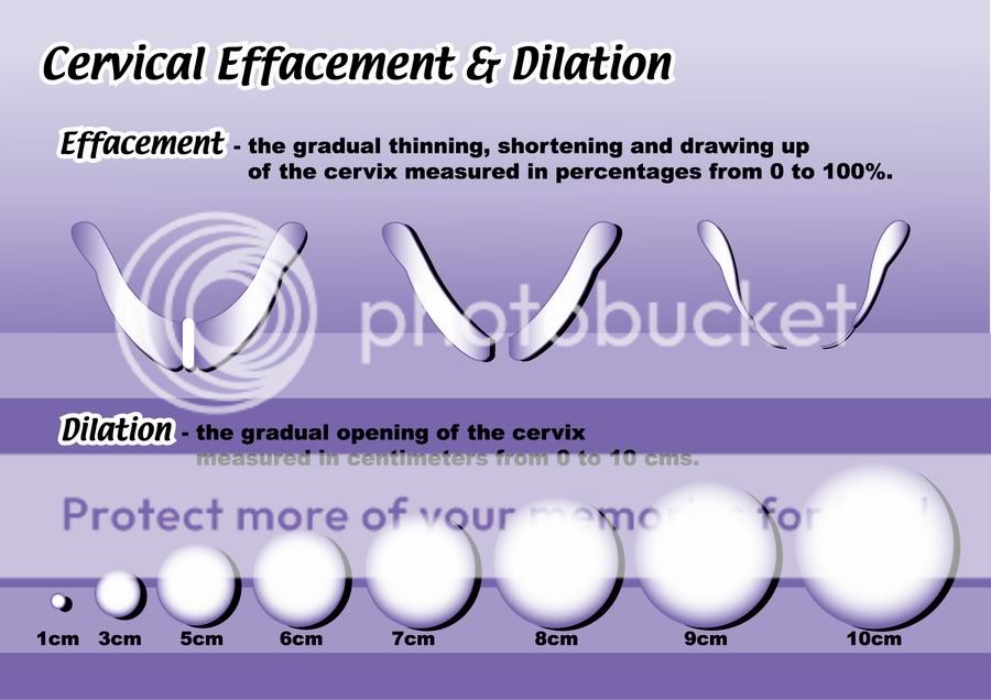 PIC/Diagram of dilation and cervical effecement BabyCenter